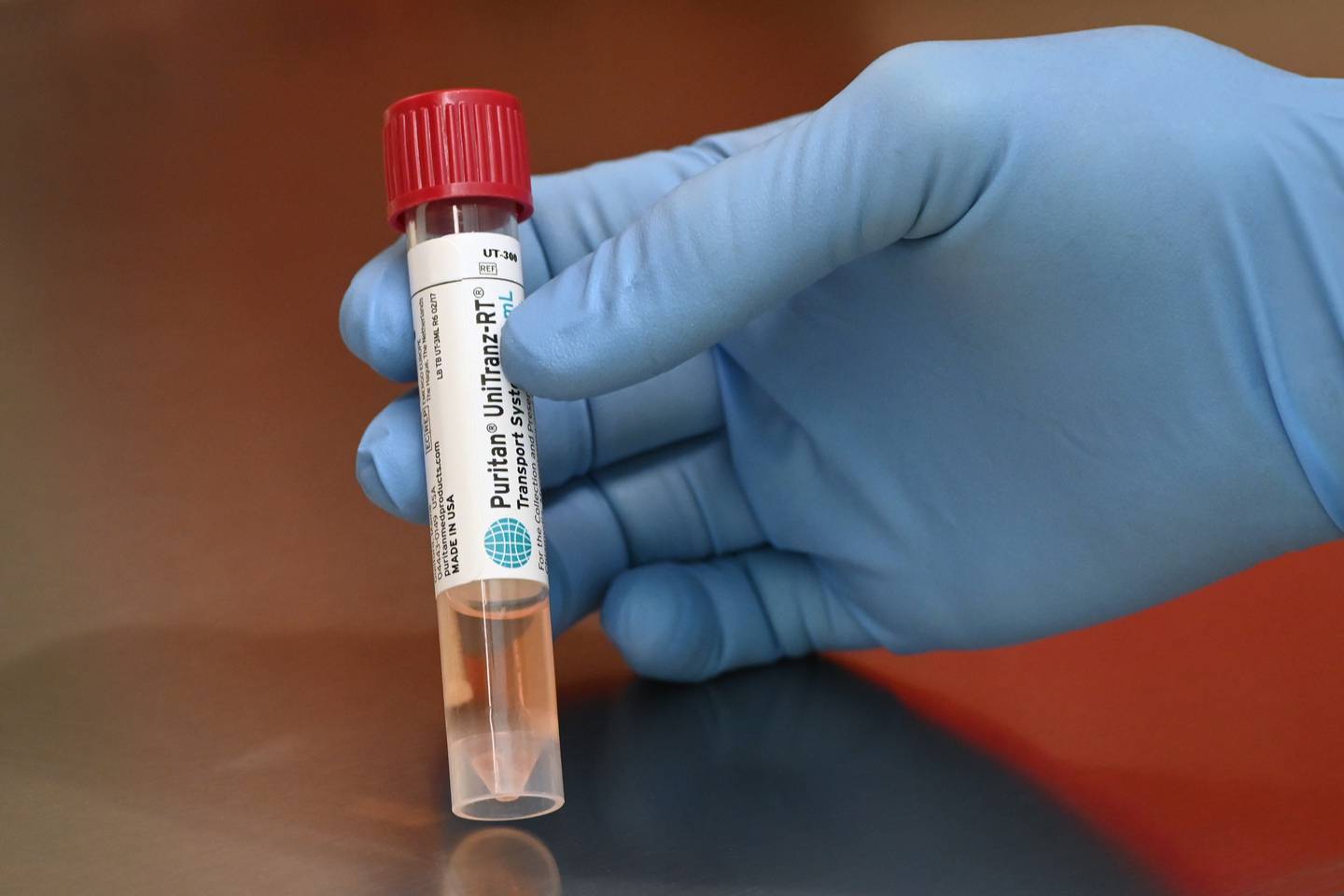 Alaska State Public Health Laboratory coronavirus testing