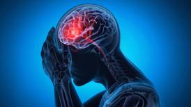 Mayo Clinic Q&A: 5 things to know about stroke