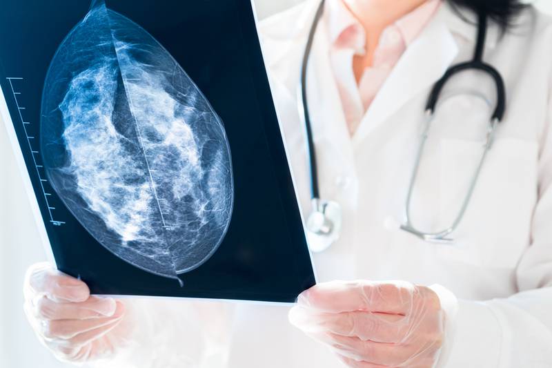 Here’s what to know about the new mammogram guidelines