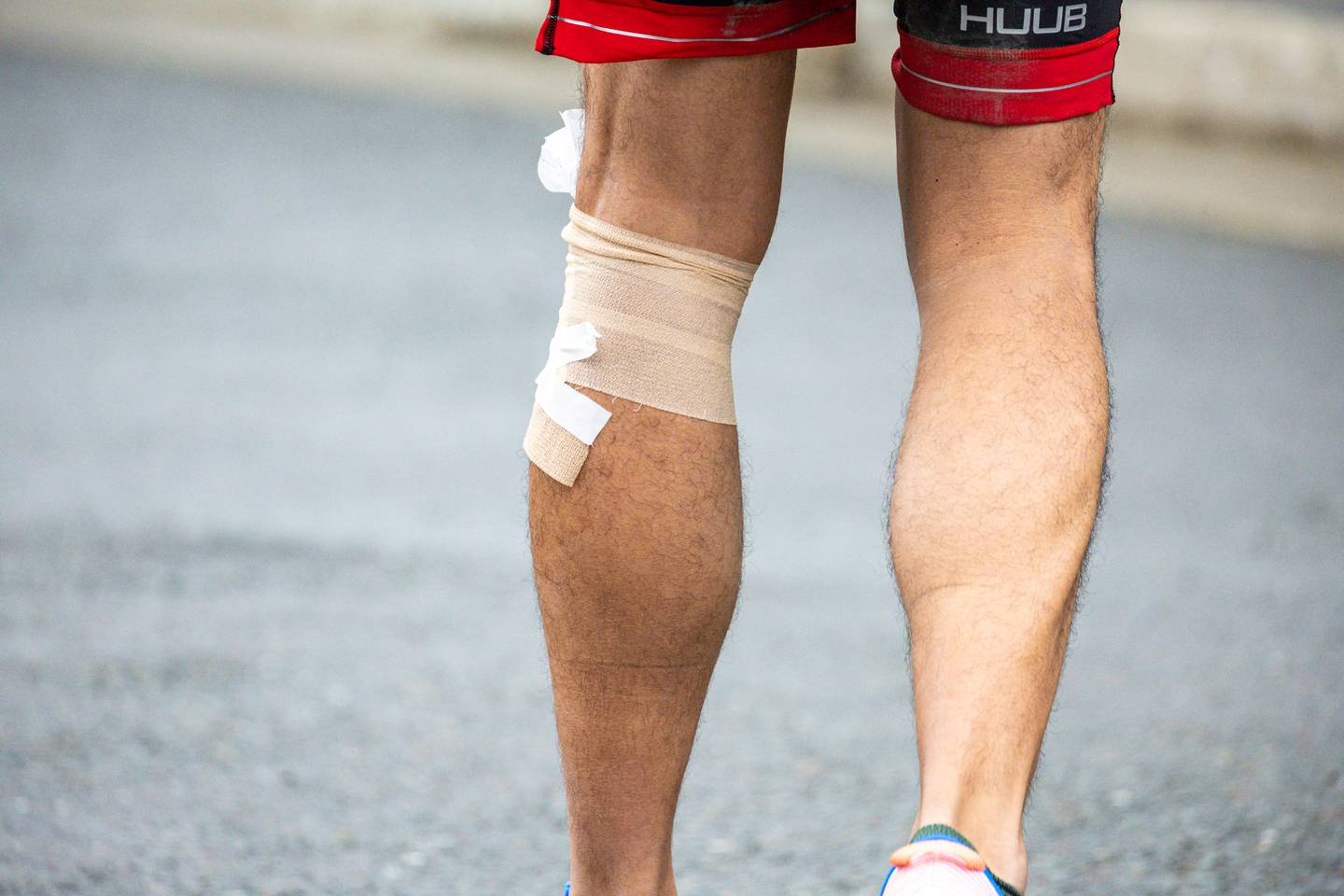 Injuries were inevitable during the Ironman Alaska race