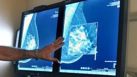Cancer Society recommends fewer, later mammograms for young women
