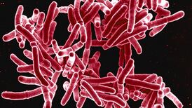 Anchorage School District reports tuberculosis case at middle school