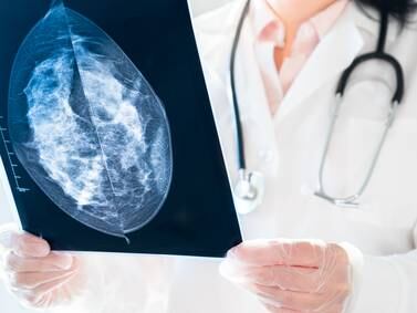 Here’s what to know about the new mammogram guidelines