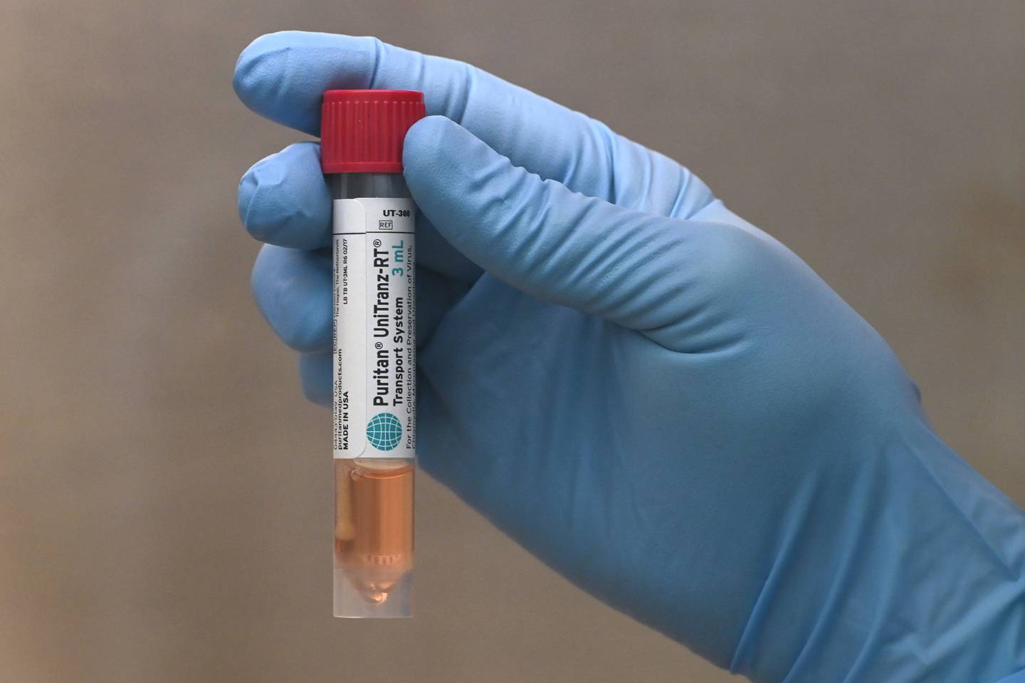 Alaska State Public Health Laboratory coronavirus testing